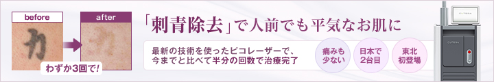 「刺青除去」で人前でも平気なお肌に