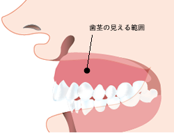 笑顔の状態