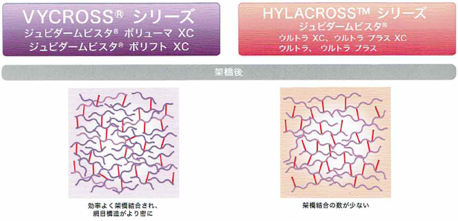 ジュビダームビスタ®ボリフトXC