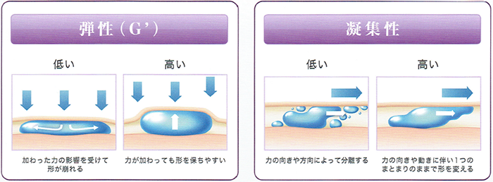 ジュビダームビスタ®ボリフトXC