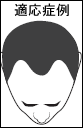適応症例
