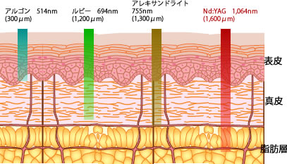可視光線領域では波長が長いほど皮膚の奥深くにレーザーが到達します