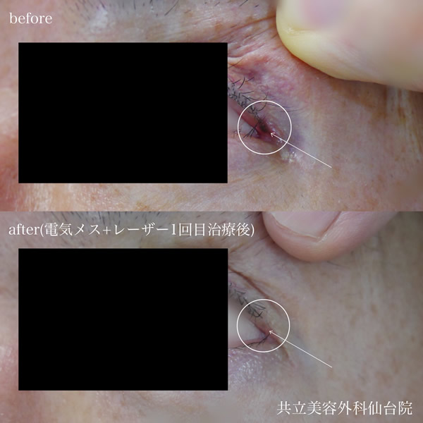 Before