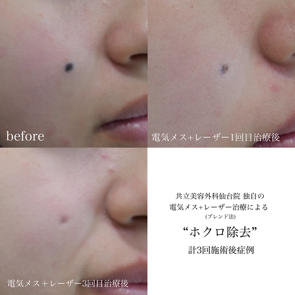 Before